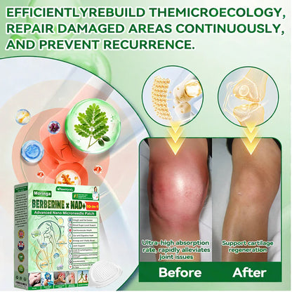 Sparklyra® Moringa &Berberine x NAD+ 10-in-1 Advanced Nano-Micro-needle Patch👩‍⚕️  (Just once a day, visible results in 7 days)  ✅ For obesity, sagging skin, diabetes and more.