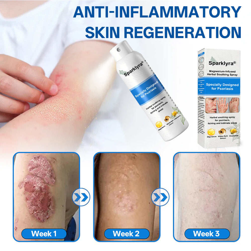💥Official shop✅: Sparklyra® Herbal magnesium spray for psoriasis