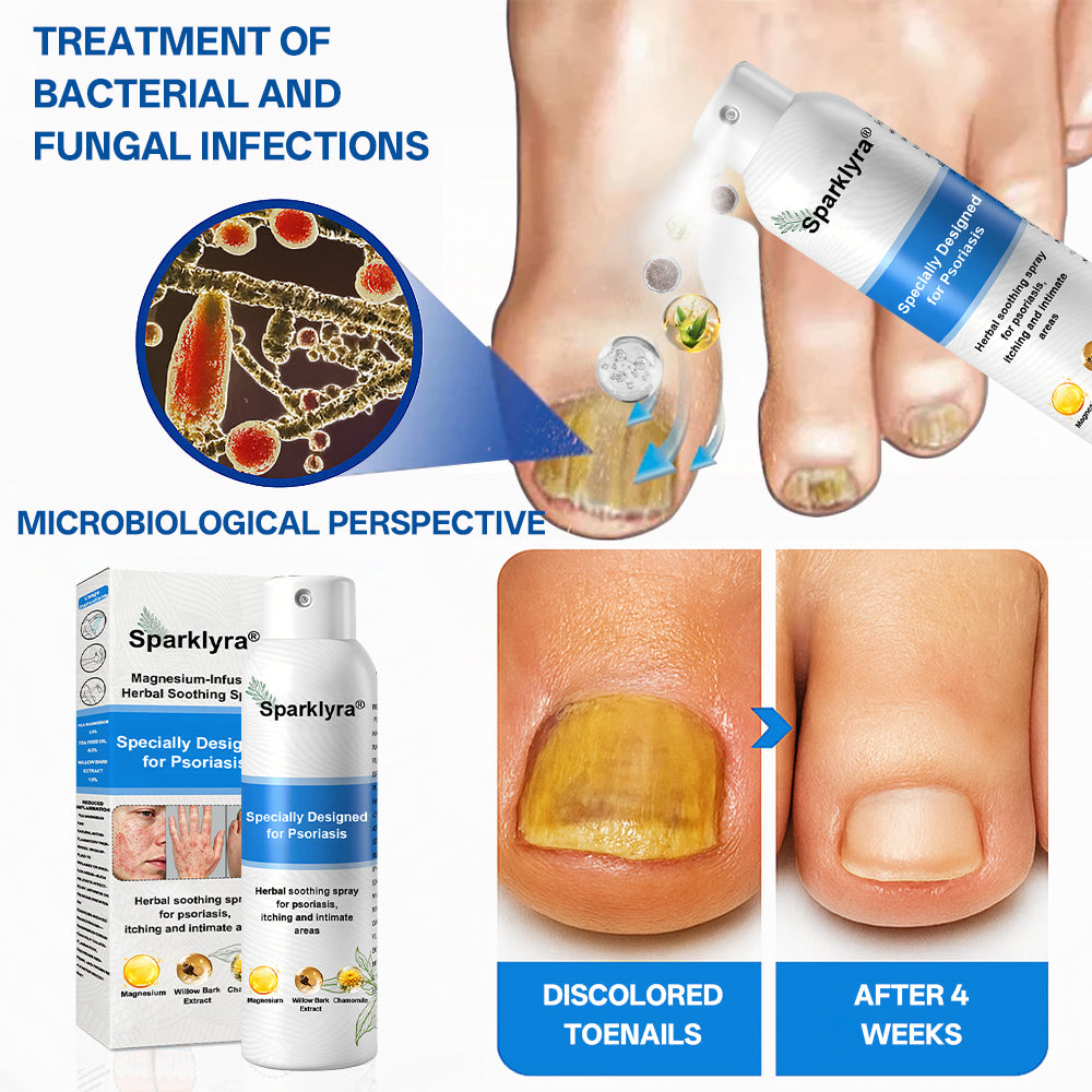 💥Official shop✅: Sparklyra® Herbal magnesium spray for psoriasis