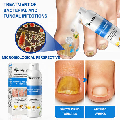 💥Official shop✅: Sparklyra® Herbal magnesium spray for psoriasis