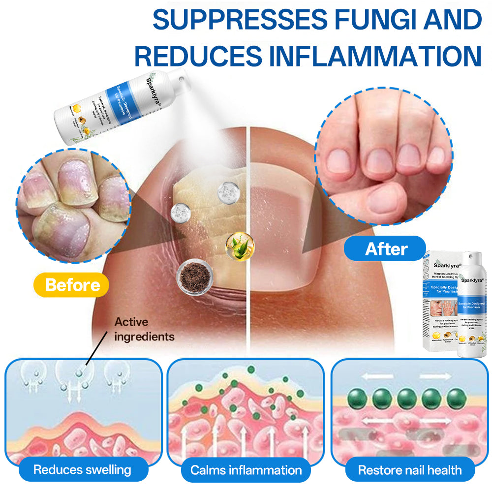 💥Official shop✅: Sparklyra® Herbal magnesium spray for psoriasis